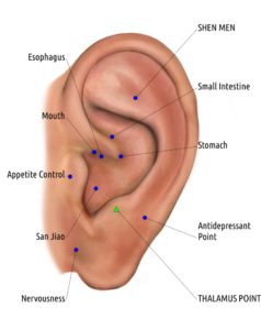 ooracupunctuur-eetlust-remmer-gezondheid-acupressur-ShenMen