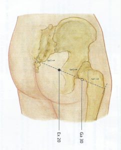 Gezondheid-workshops, acupressuur, pijn in bil, veel zitten, massage, tennisbalmassage