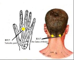 Acupressuur GB20 + ex17, hoofdpijn, nekpijn, zere ogen, energie, vermoeidheid, gezondheid-workshops