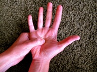 PC8 -acupressuur, anti stress, misselijkheid, hoofdpijn