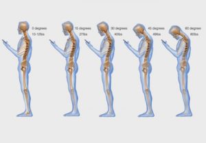 smartphone-nek, nekpijn hoofdpijn, rugpijn, gezondheid-workshops, acupressuur,